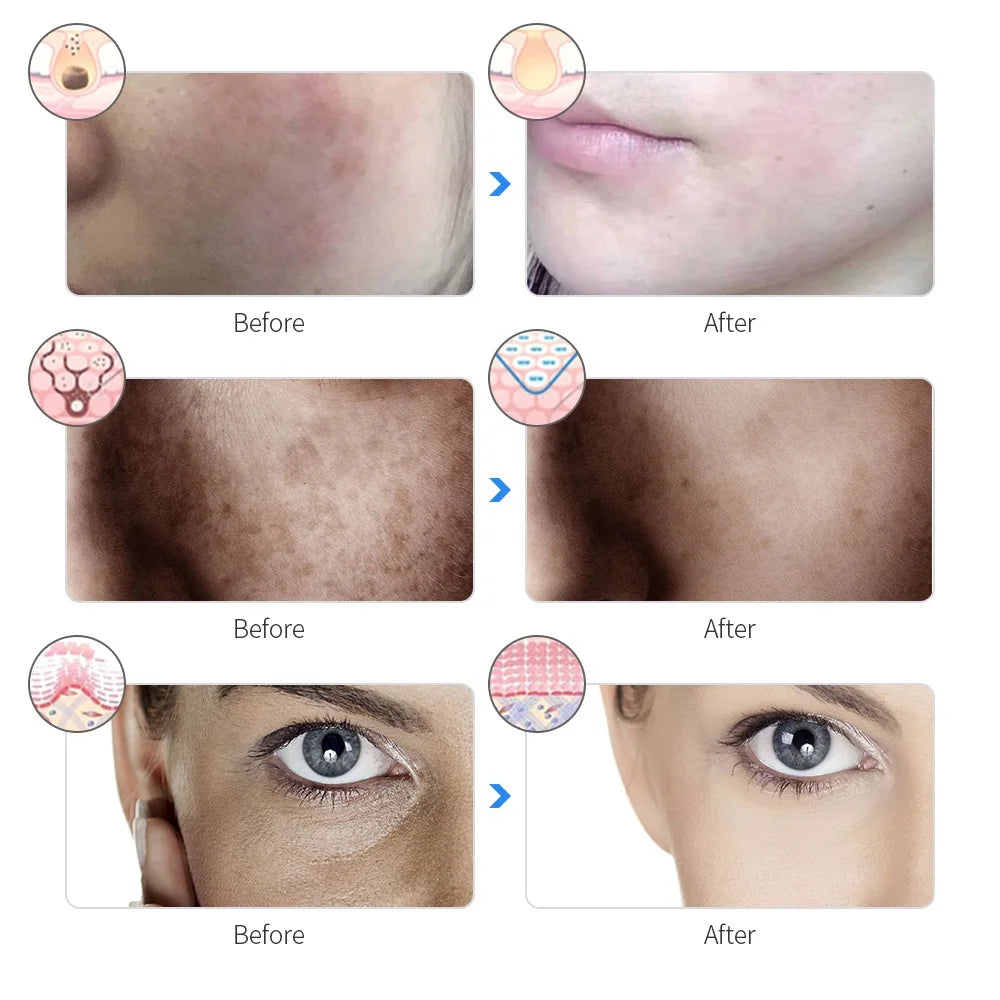 Rechargeable 7-Color LED Photon Facial Mask – Skin Rejuvenation, Lifting & Whitening Beauty Mask