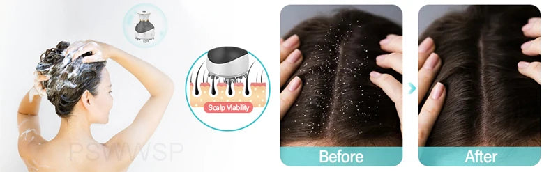 Portable Electric Scalp Head Massager