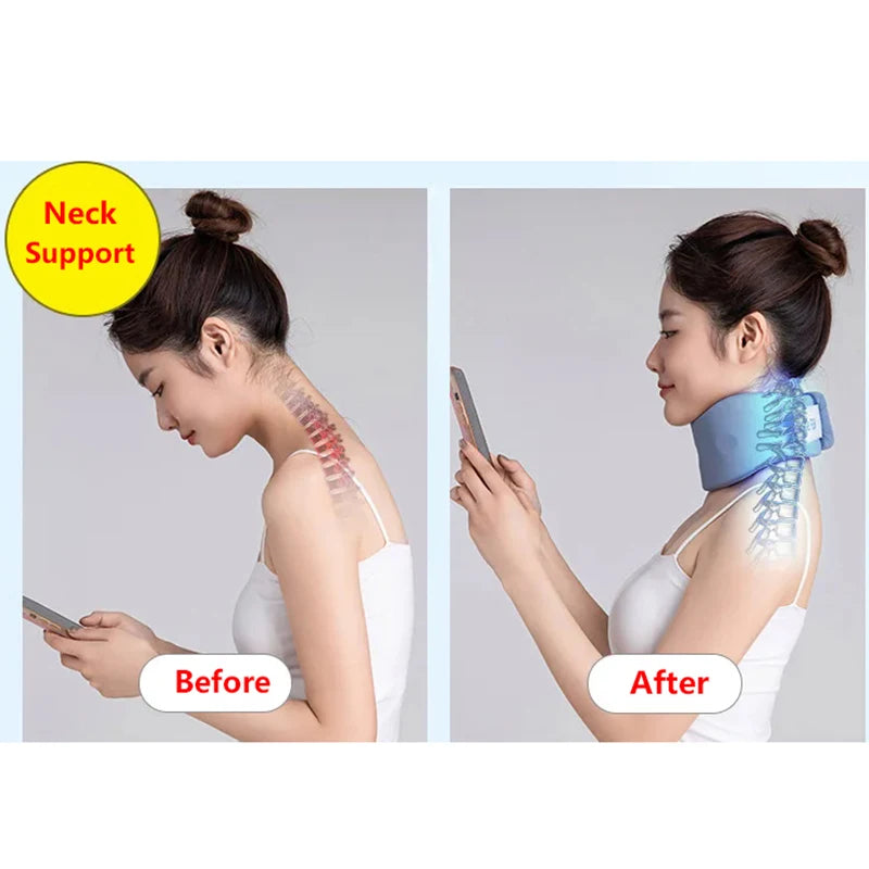 Ice Silk Cervical Collar Neck Brace – Breathable Foam Traction Support