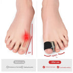 Silicone Bunion Corrector – Hallux Valgus Toe Straightener