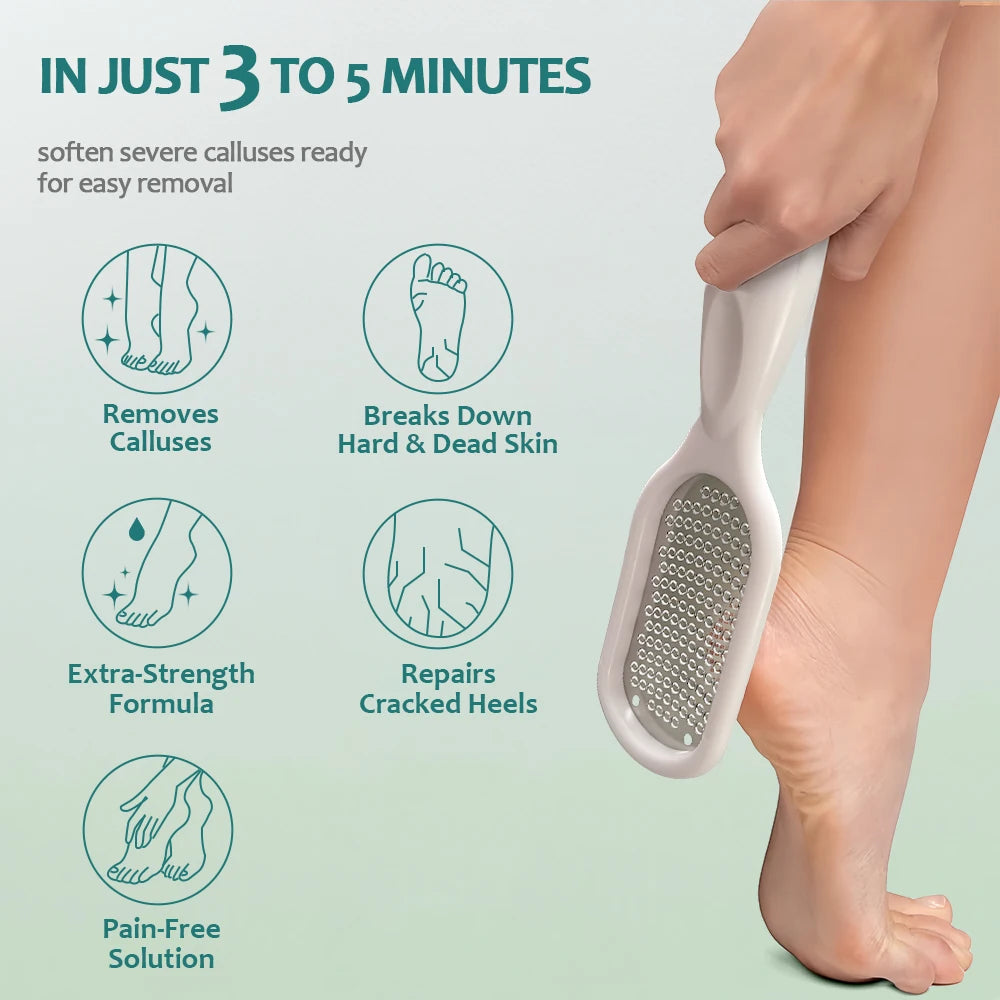 Nailpop Professional Callus Remover – Extra Strength Gel & Rasp Foot File Kit for Dead Skin & Cracked Heels