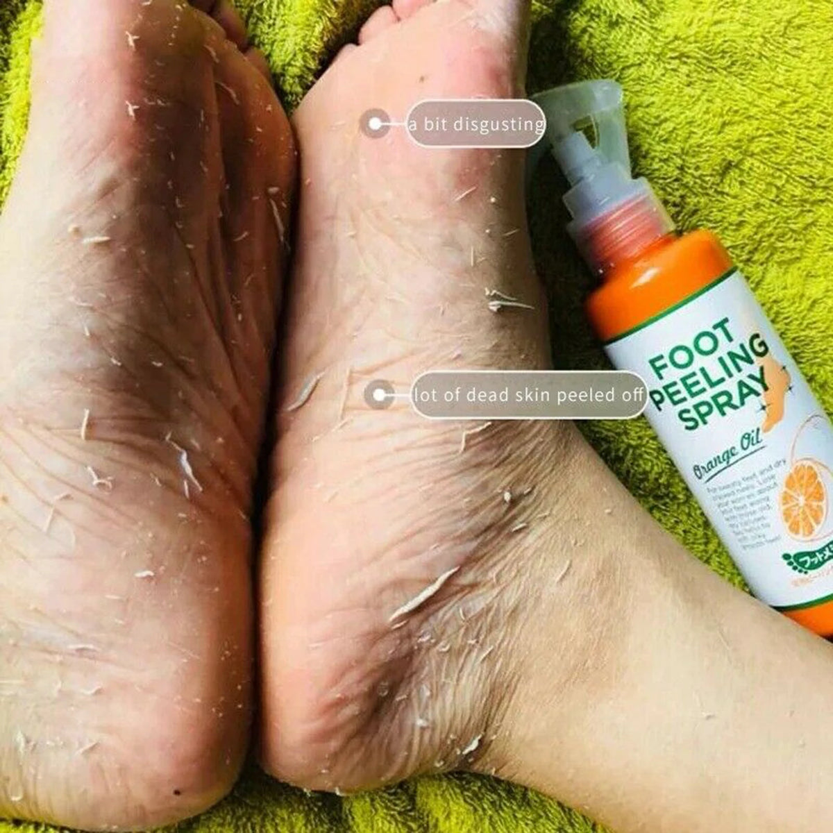 Foot Cuticle Remover & Dead Skin Exfoliator – 110ml Softener Foot Mask for Callus Removal & Pedicure