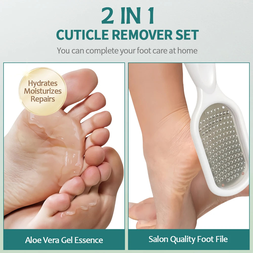 Nailpop Professional Callus Remover – Extra Strength Gel & Rasp Foot File Kit for Dead Skin & Cracked Heels