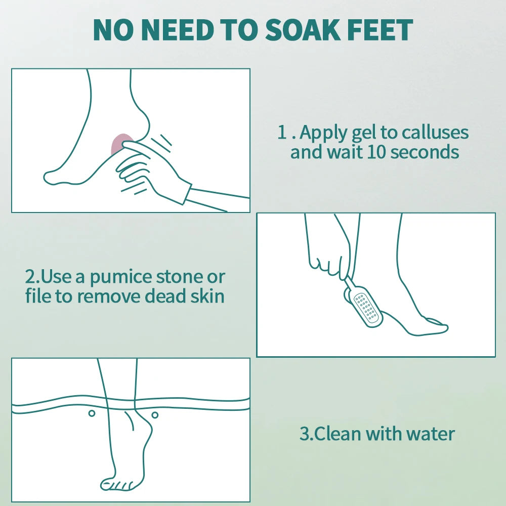 Nailpop Professional Callus Remover – Extra Strength Gel & Rasp Foot File Kit for Dead Skin & Cracked Heels