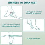 Nailpop Professional Callus Remover for Feet Extra Strength Gel & Rasp Foot File Kit Dead Skin Remover Cracked Heels Dry Skin