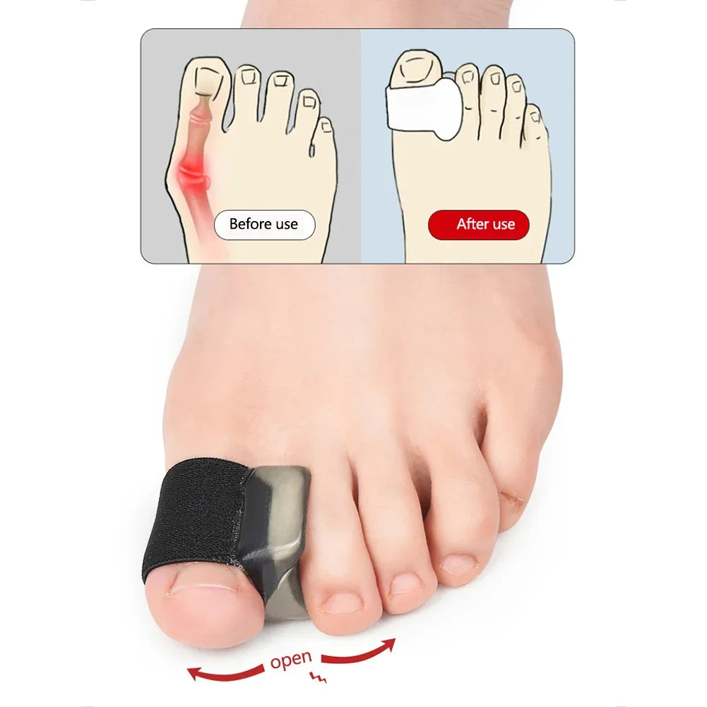 Silicone Bunion Corrector – Hallux Valgus Toe Straightener