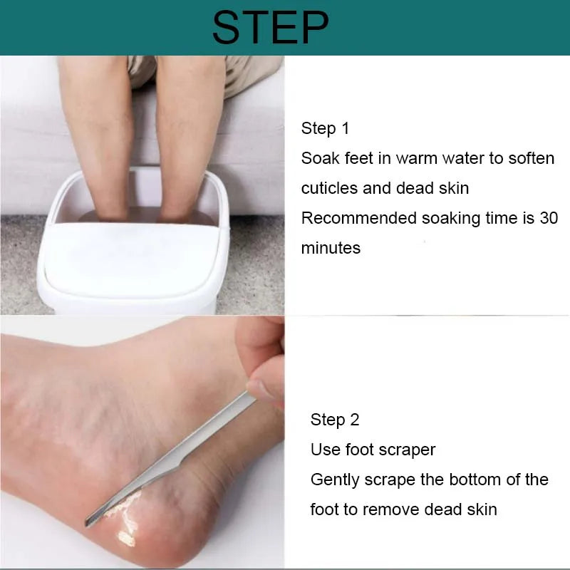 Pedicure Toe Nail Shaver Kit – Foot Callus Rasp File & Dead Skin Remover Manicure Pedicure Tools