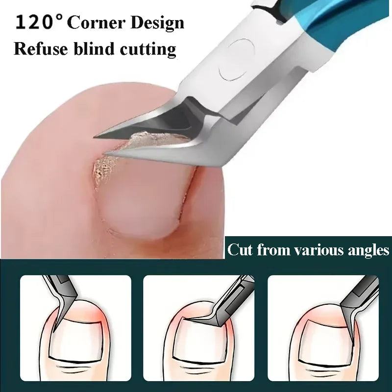 Ingrown Toenail Clipper – Thick Nail Correction Nipper with Dead Skin Remover & Pedicure Cutter