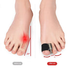 Silicone Bunion Corrector – Hallux Valgus Toe Straightener