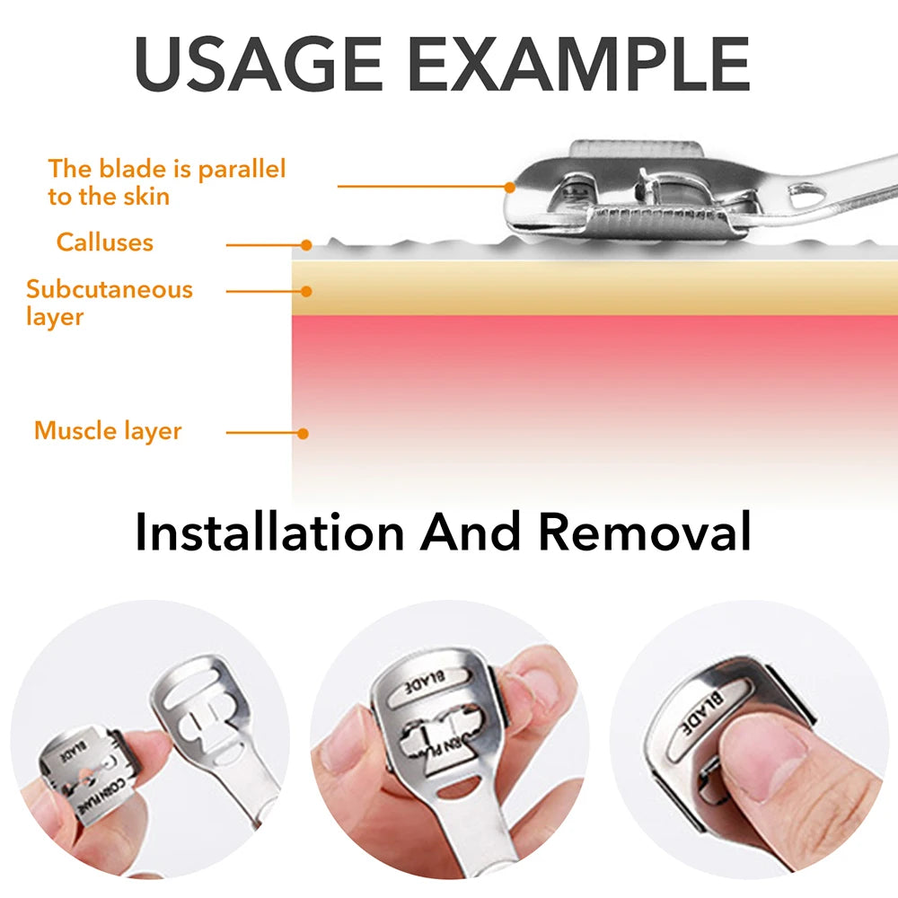 Foot Razor Callus Remover Kit – Stainless Steel Heel & Hard Skin Corn Shaver with Wood Handle & 10 Blades