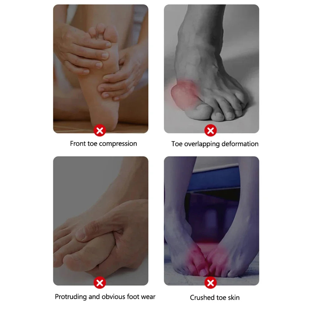 Silicone Bunion Corrector – Hallux Valgus Toe Straightener