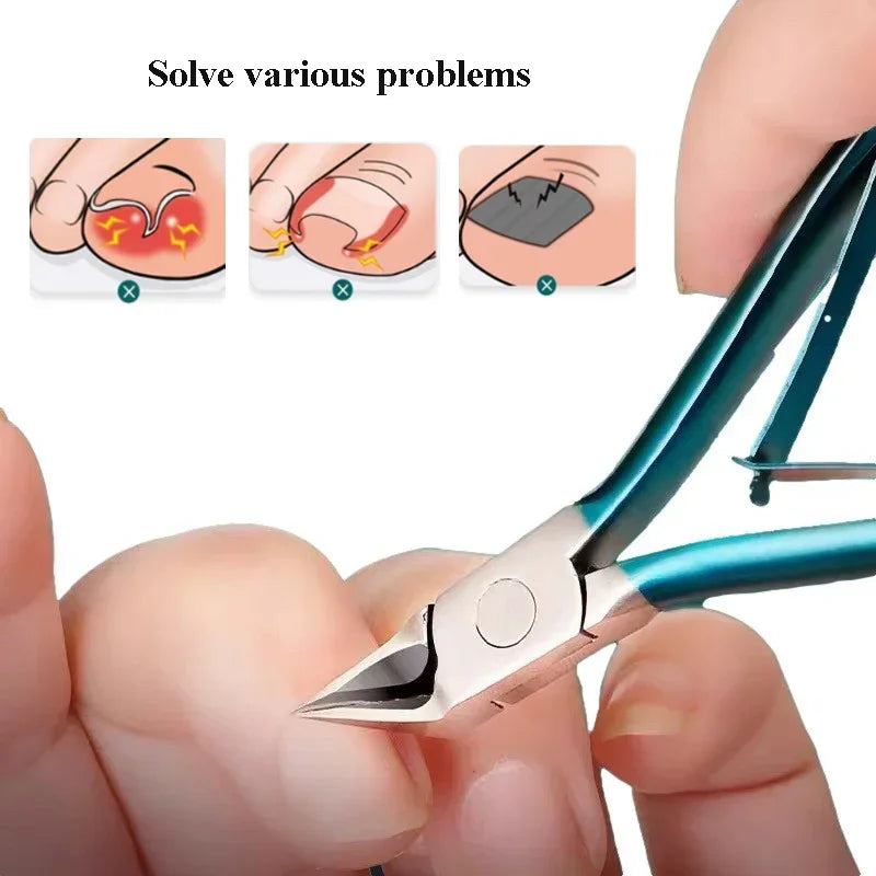 Ingrown Toenail Clipper – Thick Nail Correction Nipper with Dead Skin Remover & Pedicure Cutter