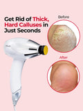 OLASALON Electric Foot Callus Remover Waterproof Foot Care Pedicure Tool Set for Callus Removal,  110V US plug